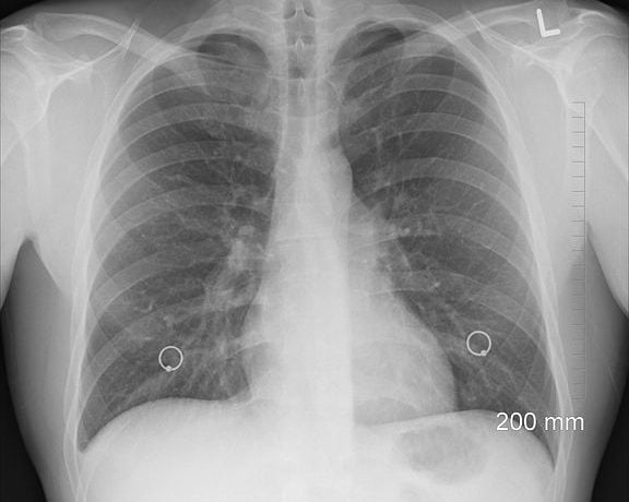 Medicina Integrativă - Abordarea Completă a Sănătății Tale